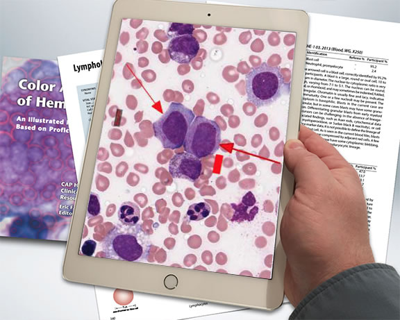 color atlas of hematology glassy pdf reader